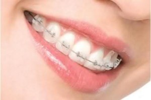 Tuổi tác hiện tại của bạn thế nào?