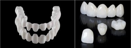Những ưu điểm của phục hình răng sứ thẫm mỹ