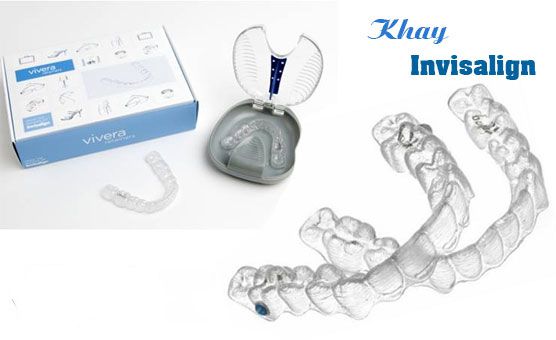 Khay niềng răng tháo lắp trong suốt