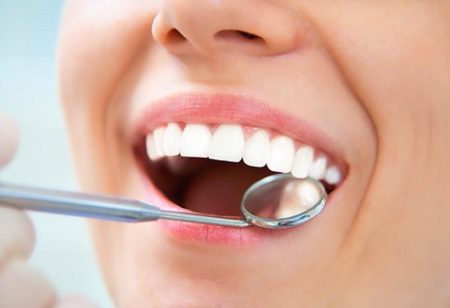Làm răng sứ mất bao lâu thì hoàn thành?