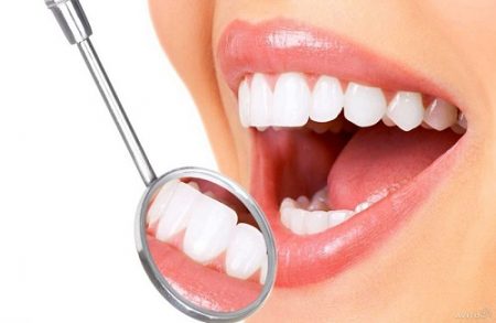 Răng sứ bị nứt phải làm sao để xử lý? Nha khoa răng sứ