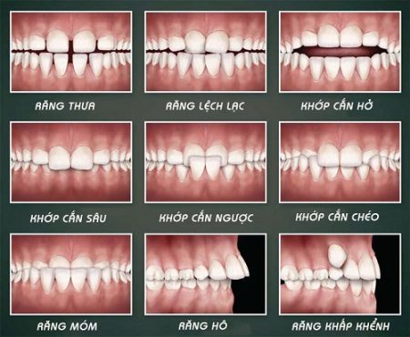 Điều trị răng miệng thẩm mỹ tại nha khoa
